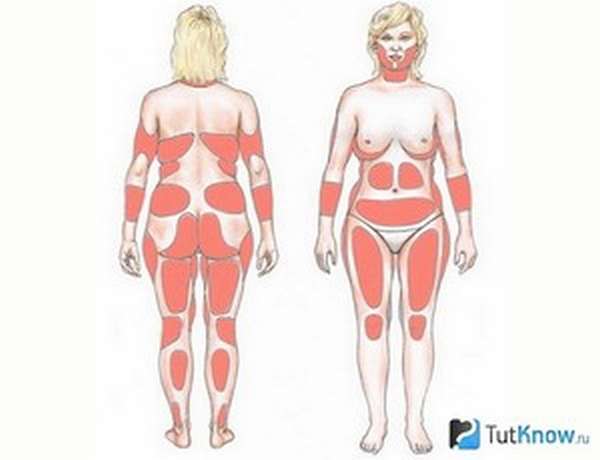 Косметология для похудения